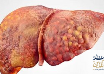 قهوه میتواند کبد شما را از مرگ نجات دهد؟